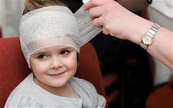 Помощь ребенку при травме головы